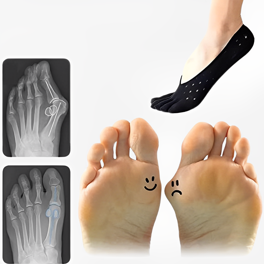 Bunion Socks