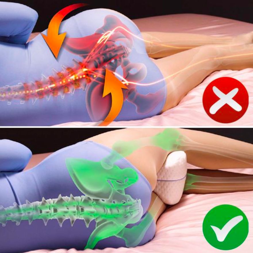 CloudAlign™ Orthopedic Cushion