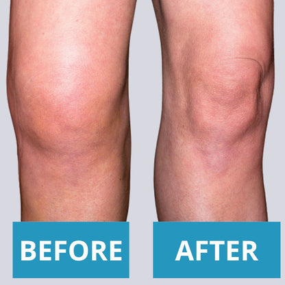 Anti-Knee pain patch