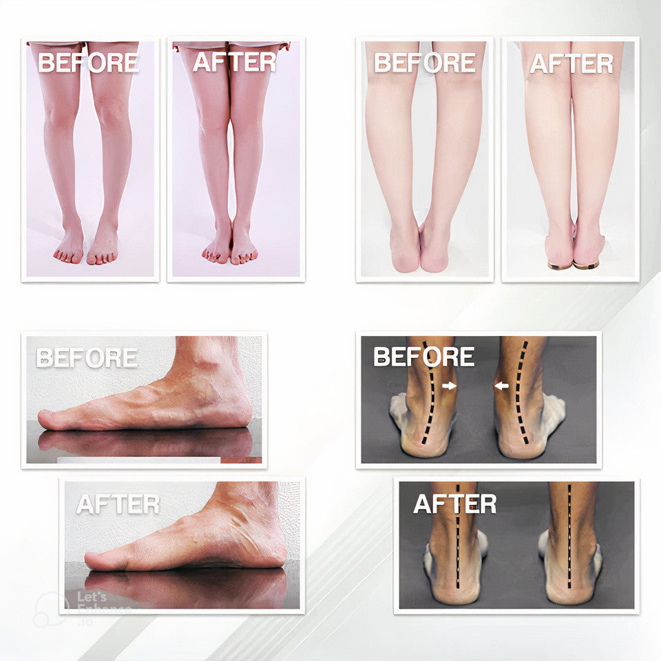 Orthopedic Insoles