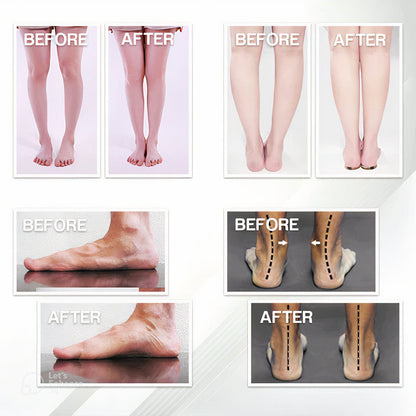 Orthopedic Insoles